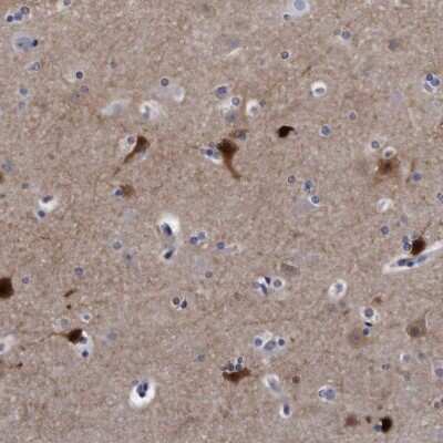 Immunohistochemistry-Paraffin: KCTD8 Antibody [NBP1-86327]