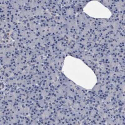 Immunohistochemistry-Paraffin: KCTD8 Antibody [NBP1-86327]