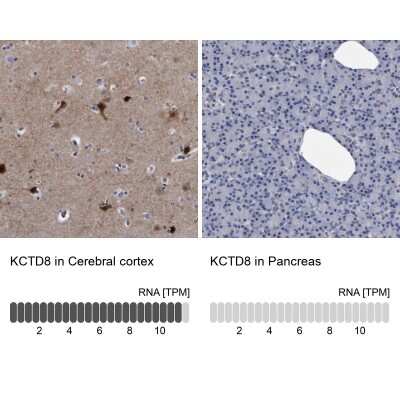 Immunohistochemistry-Paraffin: KCTD8 Antibody [NBP1-86327]