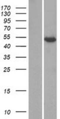 Western Blot: KCTD8 Overexpression Lysate [NBP2-04728]