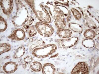 Immunohistochemistry: KCTD9 Antibody (OTI2G8) [NBP2-45488]
