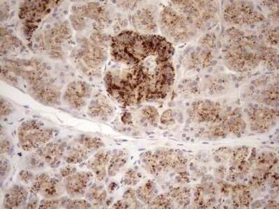 Immunohistochemistry: KCTD9 Antibody (OTI2G8) [NBP2-45488]