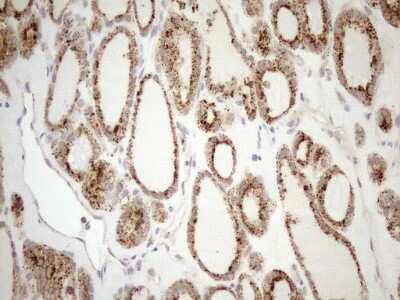 Immunohistochemistry: KCTD9 Antibody (OTI2G8) [NBP2-45488]