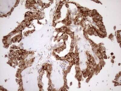 Immunohistochemistry: KCTD9 Antibody (OTI2G8) [NBP2-45488]