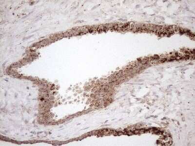 Immunohistochemistry: KCTD9 Antibody (OTI2G8) [NBP2-45488]
