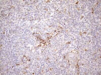 Immunohistochemistry: KCTD9 Antibody (OTI2G8) [NBP2-45488]