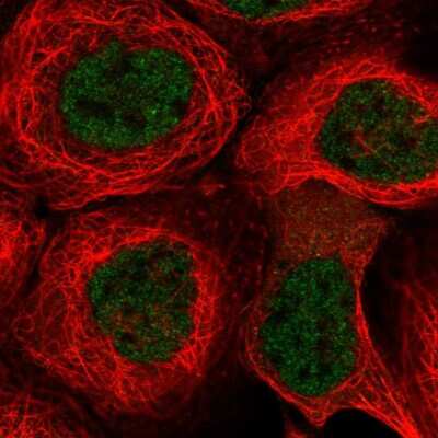 Immunocytochemistry/ Immunofluorescence: KCTD9 Antibody [NBP2-56948]