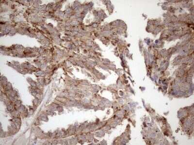 Immunohistochemistry: KCTD9 Antibody (OTI2G8) - Azide and BSA Free [NBP2-71968]