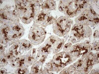 Immunohistochemistry: KCTD9 Antibody (OTI2G8) - Azide and BSA Free [NBP2-71968]