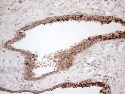 Immunohistochemistry: KCTD9 Antibody (OTI2G8) - Azide and BSA Free [NBP2-71968]