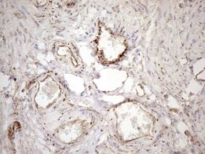 Immunohistochemistry: KCTD9 Antibody (OTI2G8) - Azide and BSA Free [NBP2-71968]