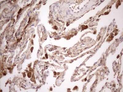 Immunohistochemistry: KCTD9 Antibody (OTI2G8) - Azide and BSA Free [NBP2-71968]