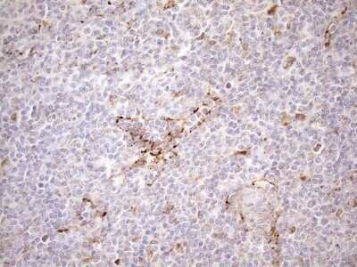 Immunohistochemistry: KCTD9 Antibody (OTI2G8) - Azide and BSA Free [NBP2-71968]