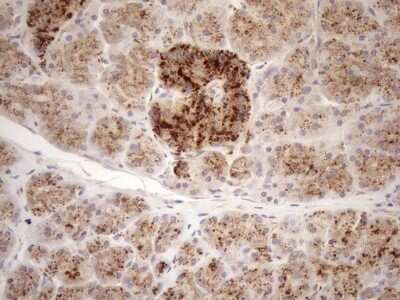 Immunohistochemistry: KCTD9 Antibody (OTI2G8) - Azide and BSA Free [NBP2-71968]