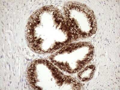 Immunohistochemistry: KCTD9 Antibody (OTI2G8) - Azide and BSA Free [NBP2-71968]
