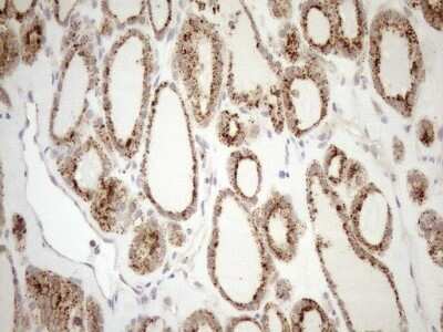 Immunohistochemistry: KCTD9 Antibody (OTI2G8) - Azide and BSA Free [NBP2-71968]