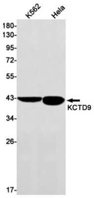 Western Blot: KCTD9 Antibody (S08-5H2) [NBP3-15051]