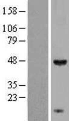 Western Blot: KCTD9 Overexpression Lysate [NBL1-12217]