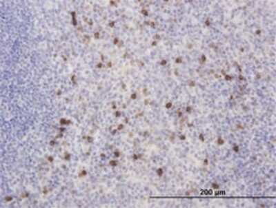 Immunohistochemistry-Paraffin: KChIP2 Antibody (3E7) [H00030819-M01]