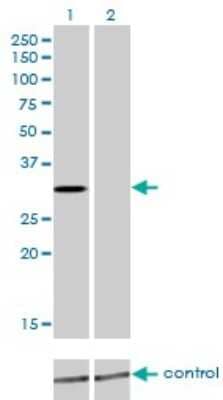 Western Blot: KChIP2 Antibody (3E7) [H00030819-M01]