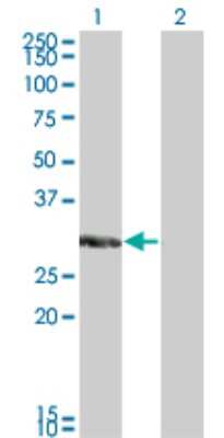 Western Blot: KChIP2 Antibody (3E7) [H00030819-M01]