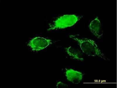 Immunocytochemistry/ Immunofluorescence: KChIP2 Antibody [H00030819-B01P]