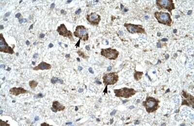 Immunohistochemistry: KChIP2 Antibody [NBP3-10370]