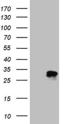 Western Blot: KChIP2 Antibody (OTI3C4)Azide and BSA Free [NBP2-71866]