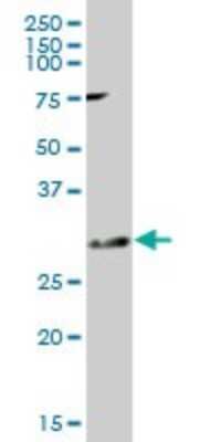 Western Blot: KChIP2 Antibody [H00030819-B01P]