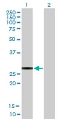 Western Blot: KChIP2 Antibody [H00030819-B01P]