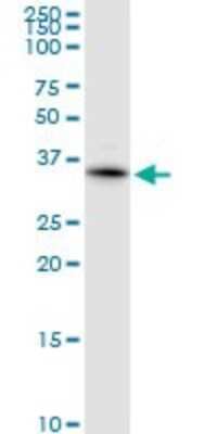 Western Blot: KChIP2 Antibody [H00030819-D01P]