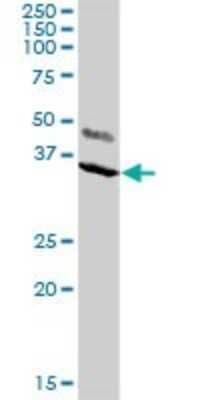 Western Blot: KChIP2 Antibody [H00030819-D01P]