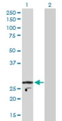 Western Blot: KChIP2 Antibody [H00030819-D01P]