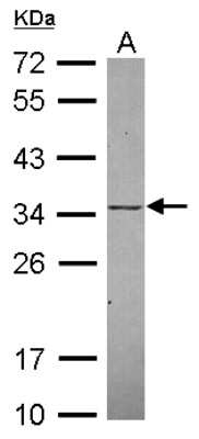 Western Blot: KChIP2 Antibody [NBP2-17026]