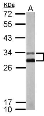 Western Blot: KChIP2 Antibody [NBP2-17026]