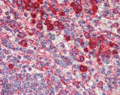 Immunohistochemistry-Paraffin: KDEL Antibody (10C3) [NBP1-97469]
