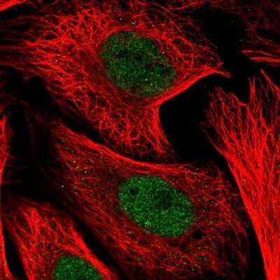 Immunocytochemistry/ Immunofluorescence: KDEL Antibody [NBP2-55448]