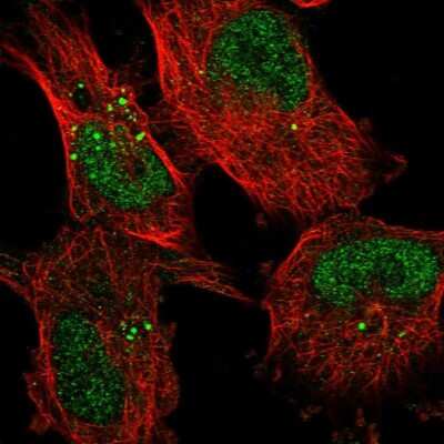 Immunocytochemistry/ Immunofluorescence: KDELC2 Antibody [NBP1-92047]