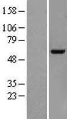 Western Blot: KDELC2 Overexpression Lysate [NBL1-12219]