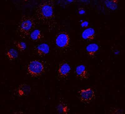 Immunocytochemistry/ Immunofluorescence: KDELR1 Antibody (KR-10) [NBP2-12873]