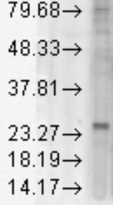 Western Blot: KDELR1 Antibody (KR-10) [NBP2-12873]