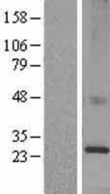 Western Blot: KDELR1 Overexpression Lysate [NBL1-12220]