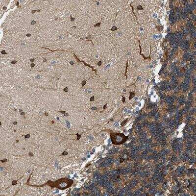 Immunohistochemistry-Paraffin: KDELR2 Antibody [NBP1-83982]