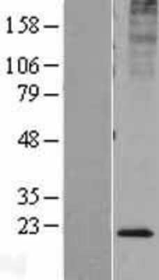 Western Blot: KDELR2 Overexpression Lysate [NBL1-12221]