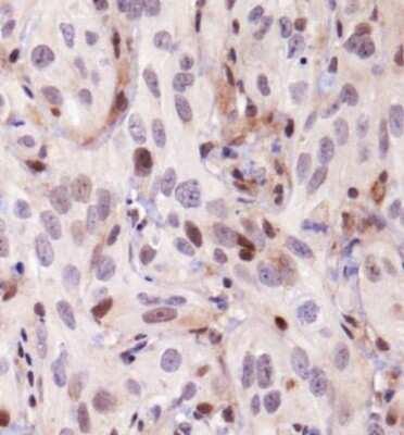 Immunohistochemistry: KDM2A/FBXL11 Antibody - BSA Free [NBP1-78305]