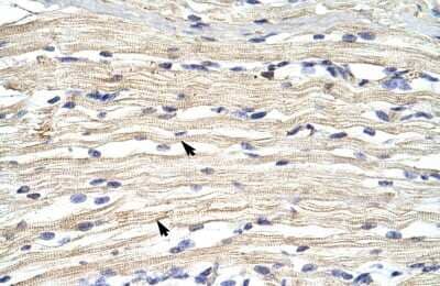Immunohistochemistry: KDM2A/FBXL11 Antibody [NBP2-86693]
