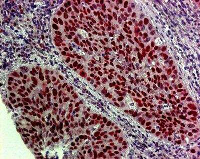 Immunohistochemistry-Paraffin: KDM2A/FBXL11 Antibody [NB100-74602]