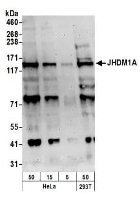 Western Blot: KDM2A/FBXL11 Antibody [NB100-74602]