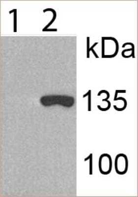 Western Blot: KDM2A/FBXL11 AntibodyBSA Free [NBP1-78305]