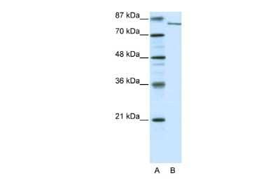 Western Blot: KDM2A/FBXL11 Antibody [NBP2-86693]